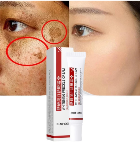 (COMPRE 1 LEVE 3 + BRINDE) CleanSkin™ 3D - Clareador de Manchas 6 Em 1